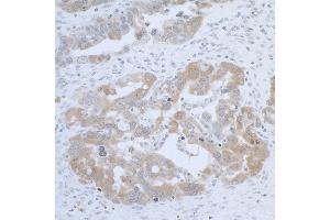 Immunohistochemistry (IHC) image for anti-Cystathionine-beta-Synthase (CBS) (AA 1-50) antibody (ABIN7453425) (CBS antibody  (AA 1-50))