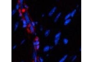 Immunofluorescence analysis of Mouse heart tissue using α-SMA Polyclonal Antibody at dilution of 1:200. (alpha-SMA antibody)