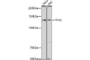 Western blot analysis of extracts of various cell lines, using TYK2 antibody (ABIN3022987, ABIN3022988, ABIN3022989 and ABIN6219333) at 1:500 dilution. (TYK2 antibody  (AA 750-850))