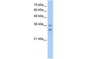 Image no. 1 for anti-Olfactory Receptor, Family 6, Subfamily C, Member 70 (OR6C70) (C-Term) antibody (ABIN205050) (OR6C70 antibody  (C-Term))