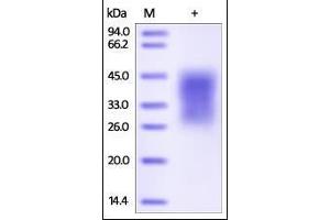 Human TIM-3, His Tag on SDS-PAGE under reducing (R) condition. (TIM3 Protein (AA 22-200) (His tag))