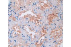 Used in DAB staining on fromalin fixed paraffin- embedded kidney tissue (SSR1 antibody  (AA 19-286))