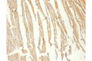 Immunohistochemistry of paraffin-embedded Mouse heart tissue using ABIN7148662 at dilution of 1:100 (CKM antibody  (AA 1-379))