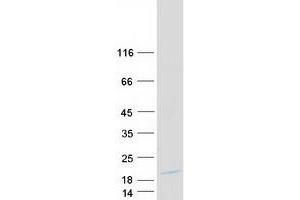 Validation with Western Blot (LYZ Protein (Myc-DYKDDDDK Tag))