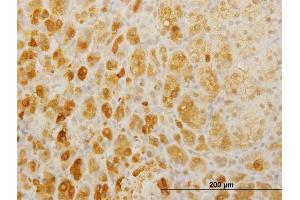 Immunoperoxidase of monoclonal antibody to TWIST2 on formalin-fixed paraffin-embedded human adrenal gland. (TWIST2 antibody  (AA 1-160))
