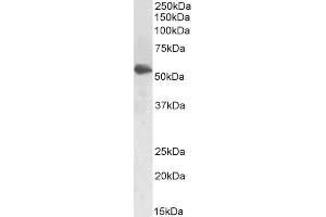 Western Blotting (WB) image for anti-Lecithin-Cholesterol Acyltransferase (LCAT) (AA 366-378) antibody (ABIN5902634) (LCAT antibody  (AA 366-378))