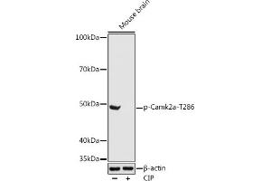 Western blot analysis of extracts of Mouse brain, using Phospho-Camk2a-T286 antibody (ABIN3019946, ABIN3019947, ABIN3019948 and ABIN1681430) at 1:1000 dilution. (CAMK2A antibody  (pThr286))