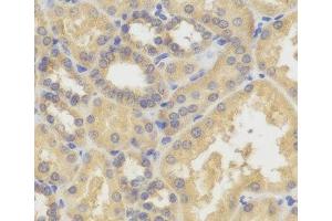 Immunohistochemistry of paraffin-embedded Human kidney using SMYD5 Polyclonal Antibody (SMYD5 antibody)