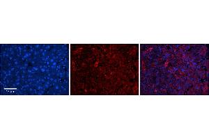 Rabbit Anti-DHX30 Antibody      Formalin Fixed Paraffin Embedded Tissue: Human Adult Liver   Observed Staining: Cytoplasm in hepatocytes, moderate signal, wide tissue distribution  Primary Antibody Concentration: 1:100  Secondary Antibody: Donkey anti-Rabbit-Cy3  Secondary Antibody Concentration: 1:200  Magnification: 20X  Exposure Time: 0. (DHX30 antibody  (N-Term))
