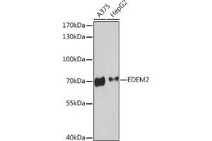 Western blot analysis of extracts of various cell lines, using EDEM2 Rabbit pAb (ABIN7267004) at 1:3000 dilution. (EDEM2 antibody  (AA 399-578))