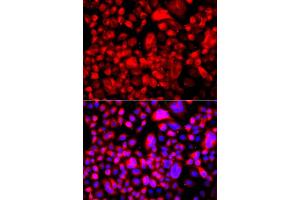Immunofluorescence analysis of A549 cell using FASN antibody. (Fatty Acid Synthase antibody)