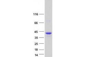 Western Blotting (WB) image for Nucleoporin 35kDa (NUP35) protein (Myc-DYKDDDDK Tag) (ABIN2727810)