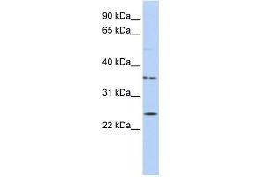 WB Suggested Anti-IQCF1 Antibody Titration: 0. (IQCF1 antibody  (Middle Region))