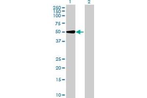 UGT2A3 antibody  (AA 1-527)