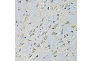 Immunohistochemistry of paraffin-embedded mouse brain using DARS antibody (ABIN5973949) at dilution of 1/100 (40x lens). (DARS antibody)