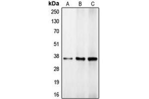 Western blot analysis of C/EBP beta expression in HeLa (A), mouse brain (B), rat kidney (C) whole cell lysates. (CEBPB antibody  (Center))