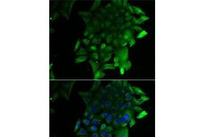 Immunofluorescence analysis of U2OS cells using SEPSECS Polyclonal Antibody (SEPSECS antibody)