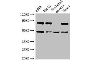 Western Blot Positive WB detected in: A549 whole cell lysate, HepG2 whole cell lysate, Mouse skeletal muscle tissue, Rat heart tissue All lanes: ASB4 antibody at 3 μg/mL Secondary Goat polyclonal to rabbit IgG at 1/50000 dilution Predicted band size: 49, 39 kDa Observed band size: 49 kDa (ASB4 antibody  (AA 166-321))