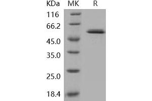 Western Blotting (WB) image for Glucokinase (Hexokinase 4) (GCK) protein (ABIN7317079) (GCK Protein)