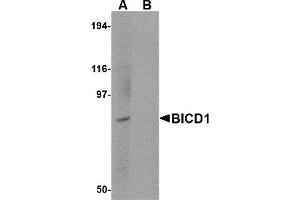 Western Blotting (WB) image for anti-Bicaudal D Homolog 1 (BICD1) (C-Term) antibody (ABIN1030294) (BICD1 antibody  (C-Term))