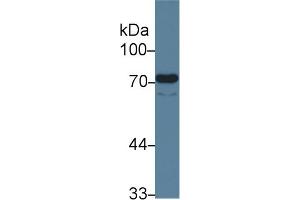 Detection of ENG in Human Lung lysate using Monoclonal Antibody to Endoglin (ENG) (Endoglin antibody  (AA 26-136))