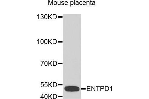 CD39 antibody  (AA 1-180)