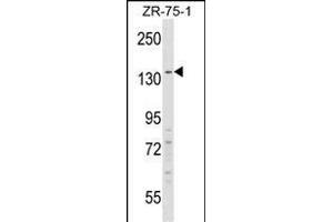 RFX1 Antibody (C-term) (ABIN1537643 and ABIN2848461) western blot analysis in ZR-75-1 cell line lysates (35 μg/lane). (RFX1 antibody  (C-Term))