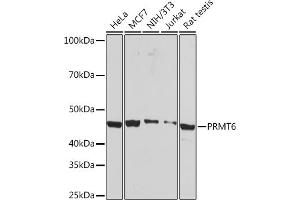 Western blot analysis of extracts of various cell lines, using PRMT6 Rabbit mAb (ABIN7269606) at 1:1000 dilution. (PRMT6 antibody)
