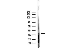 anti-Visual System Homeobox 2 (VSX2) (Internal Region) antibody