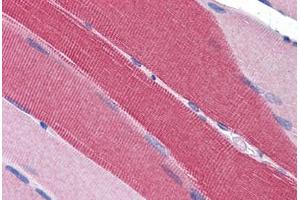 Human Skeletal Muscle: Formalin-Fixed, Paraffin-Embedded (FFPE) (PDE4D antibody  (AA 796-809))