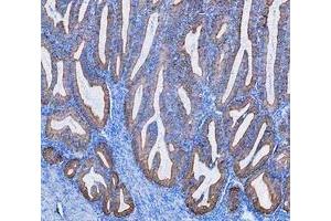 IHC analysis of Cytokeratin 8/KRT8 using anti-Cytokeratin 8/KRT8 antibody (ABIN5518853). (KRT8 antibody  (AA 107-325))