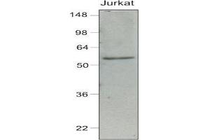 Cell lysates of Jurkat (40 ug) were resolved by SDS-PAGE, transferred to nitrocellulose membrane and probed with anti-human IRF-7 (1:1,000).