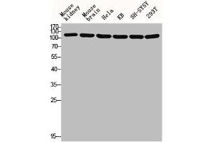 TUBGCP5 antibody  (Internal Region)