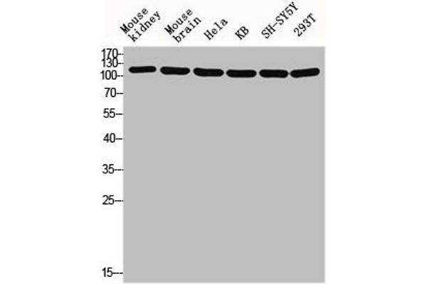 TUBGCP5 antibody  (Internal Region)