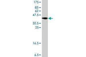 Western Blot detection against Immunogen (37. (USP34 antibody  (AA 3296-3395))