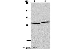 Western blot analysis of Human testis and prostate tissue, using HAS1 Polyclonal Antibody at dilution of 1:350 (HAS1 antibody)