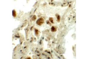 Immunohistochemical staining of human lung cells with RASSF10 polyclonal antibody  at 5 ug/mL. (RASSF10 antibody  (N-Term))