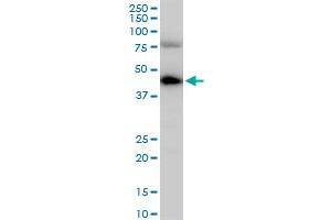 COPS3 polyclonal antibody (A01), Lot # 060113JC01. (COPS3 antibody  (AA 324-422))