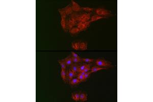 Immunofluorescence analysis of C6 cells using RTKN Rabbit pAb (ABIN6129097, ABIN6147290, ABIN6147292 and ABIN6222455) at dilution of 1:100 (40x lens). (Rhotekin antibody  (AA 254-513))