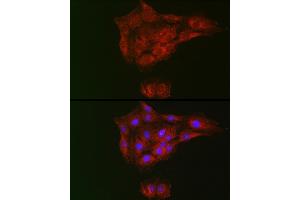 Immunofluorescence analysis of C6 cells using RTKN Rabbit pAb (ABIN6129097, ABIN6147290, ABIN6147292 and ABIN6222455) at dilution of 1:100 (40x lens). (Rhotekin antibody  (AA 254-513))