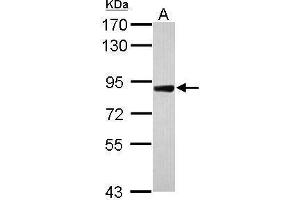 WB Image Sample (30 ug of whole cell lysate) A: Raji 7. (DDR2 antibody  (C-Term))