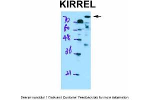 WB Suggested Anti-KIRREL Antibody Titration: 0.