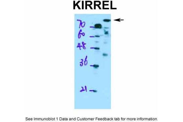 KIRREL antibody  (Middle Region)