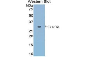 Western Blotting (WB) image for anti-Toll Interacting Protein (TOLLIP) (AA 28-261) antibody (ABIN1860826) (TOLLIP antibody  (AA 28-261))