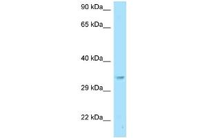 WB Suggested Anti-Gnb2l1 Antibody Titration: 1.