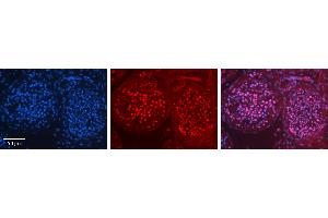 Rabbit Anti-ILF3 Antibody   Formalin Fixed Paraffin Embedded Tissue: Human Testis Tissue Observed Staining: Nucleus in spermatogonia and spermatocytes Primary Antibody Concentration: 1:100 Other Working Concentrations: 1:600 Secondary Antibody: Donkey anti-Rabbit-Cy3 Secondary Antibody Concentration: 1:200 Magnification: 20X Exposure Time: 0. (Interleukin enhancer-binding factor 3 (ILF3) (C-Term) antibody)