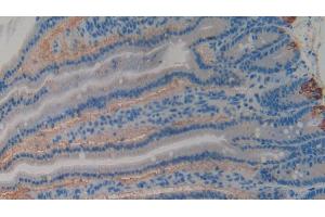 Detection of GP1BB in Rat Intestine Tissue using Polyclonal Antibody to Platelet Glycoprotein Ib Beta Chain (GP1BB)