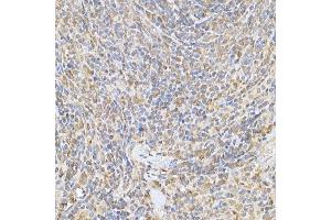 Immunohistochemistry of paraffin-embedded rat spleen using SOCS1 Rabbit pAb (ABIN6128737, ABIN6148263, ABIN6148266 and ABIN6223700) at dilution of 1:250 (40x lens). (SOCS1 antibody  (AA 1-211))