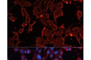 Immunofluorescence analysis of NIH/3T3 cells using ADAM12 Polyclonal Antibody at dilution of 1:100.