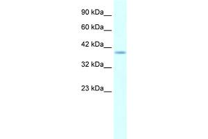 Image no. 1 for anti-H6 Family Homeobox 1 (HMX1) (Middle Region) antibody (ABIN2779760) (HMX1 antibody  (Middle Region))